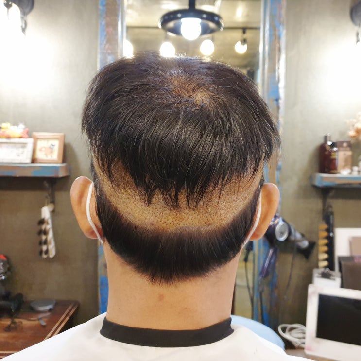 머리숱 없는 남자 투블럭이 해답 일까?