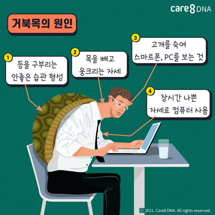  [땀나는] 거북목 모여라. 거북목 자가 진단법, 원인, 거북목 스트레칭