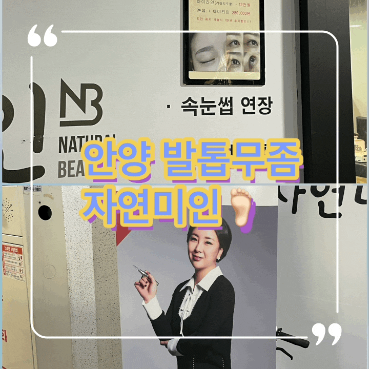  안양 발톱무좀 자연미인에서 시원하게 해결했어요