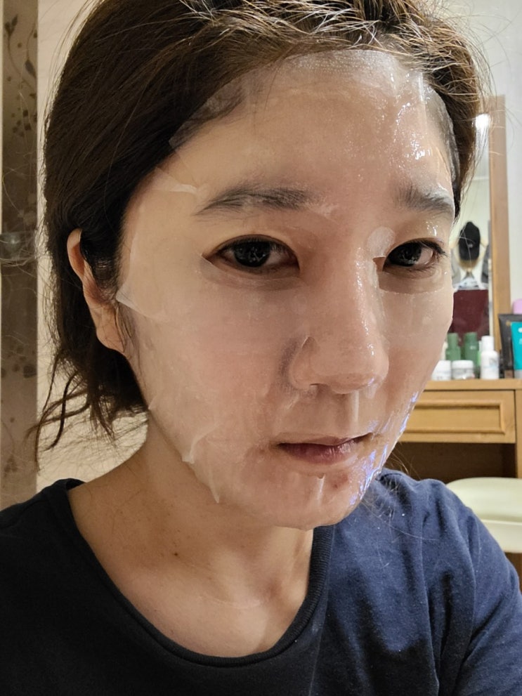  편평사마귀 제거 토침으로 하고 왔어요