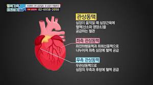 간호학 심내막염 심근염 심낭염 원인증상 치료약물간호 문헌고찰케이스