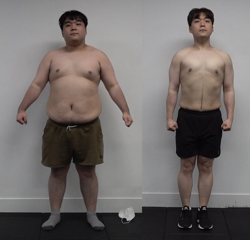 고도비만 다이어트를 올바르게 하는 방법