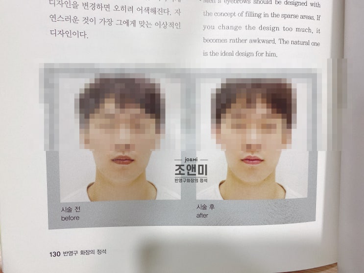 반영구화장아카데미 :: 입술문신부작용 줄이는 방법 -2 / 남자입술문신 반영구화장아카데미 :: 입술문신부작용 줄이는 방법 -2 / 남자입술문신