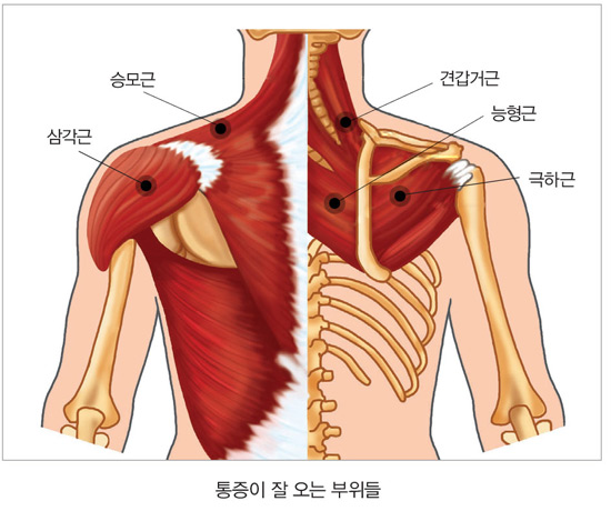  지야와 요가 } DAY 31_백일수련웅녀일기 ~ 어깨 담 푸는 비법과 비밀의 도구!!! [ 특명 : 능형근을 자극해라 ]