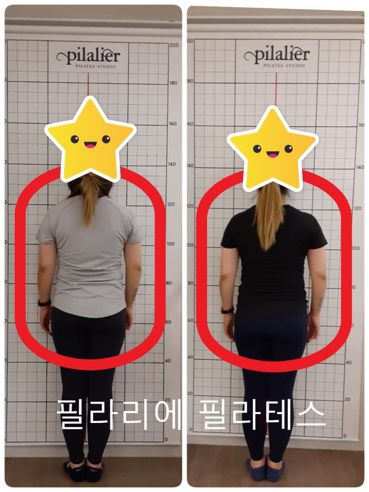  [이수역체형교정]직각어깨 & 상체 다이어트 변화