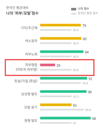  [유전자 연구소 #14] 아토피 피부염 발생 원인, 예방 및 치료법. feat. 아토피 피부염 유전자