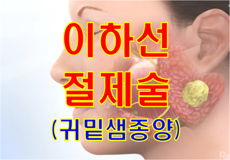 귀밑에 몽우리가 만져지는 40세 여자 - 이하선절제술의 모든것