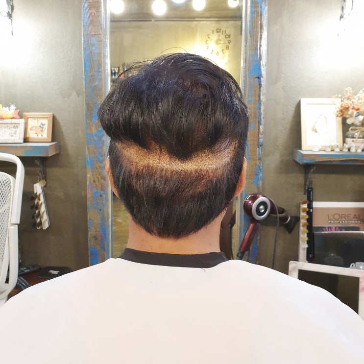  모발이식생착기간 후두부 관리 방법