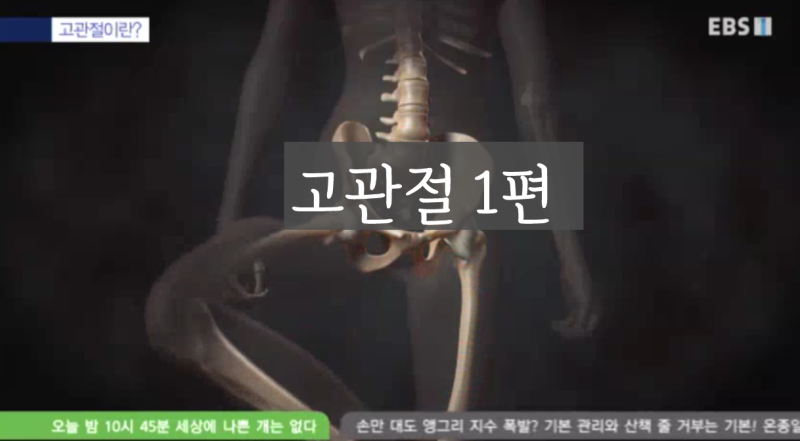 [EBS명의] 고관절 질환, 아파도 너무 아프다 1편ㅣ이우석 교수