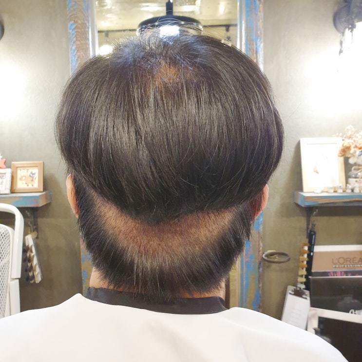  수염이식 전 하지 말아야 할 것