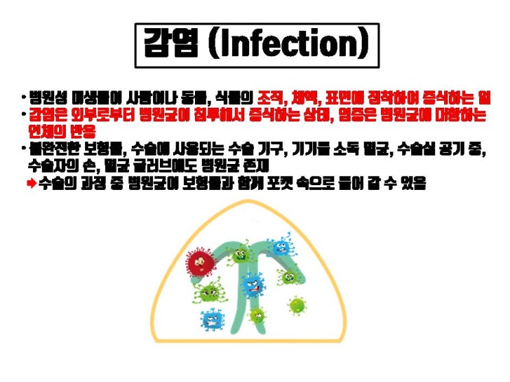  코수술 염증이 생겼다고 무조건 코보형물 제거해야 하는 거 아니에요!!! 코수술 후 감염이 생기면 무조건 코보형물을 빼야하죠.