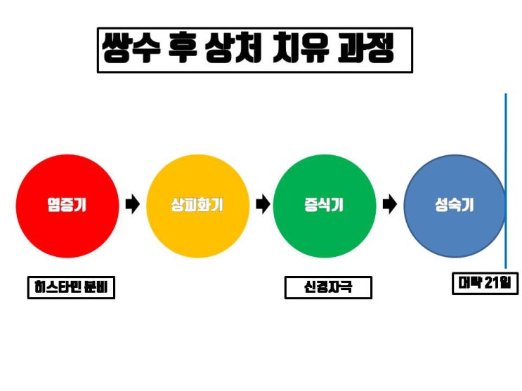  쌍수 후 가려움 절개 상처 치유 과정에서 자연스럽게 나타날 수 있는 증상. 너무 걱정 말아요~~