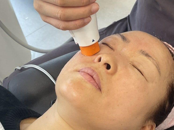 강서 피부과 추천 올리지오 가격, 효과 솔직후기