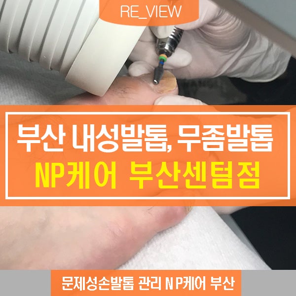  NP케어 부산센텀점 내성발톱 (feat. 부산무좀발톱 )