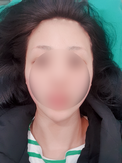  [내돈내산] 부산 30대 리프팅 후기 "인어젯"