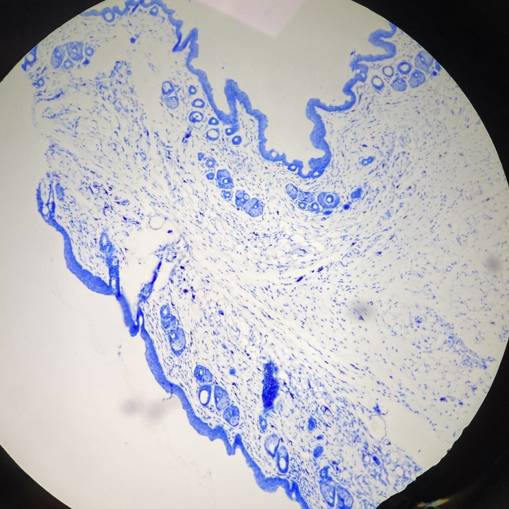  조직염색-Toluidine blue stain(톨루이딘블루염색)