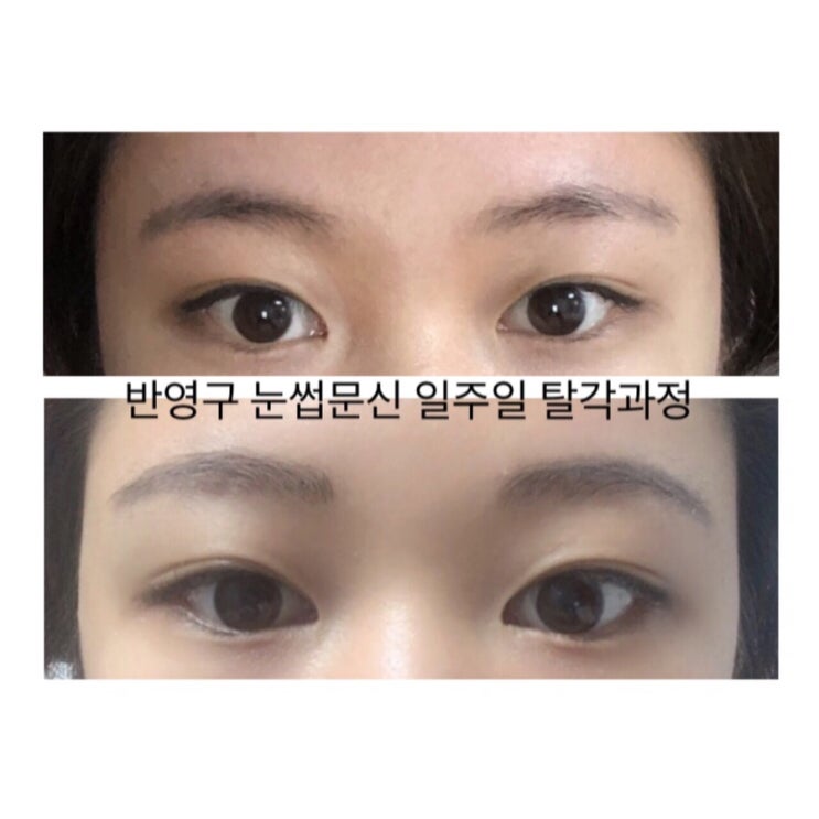  반영구 눈썹문신 탈각과정 :: 엘리씨의 일주일 후기 (사진많음)