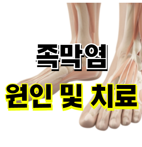  족막염 원인 및 치료 방법 - 근저족막염 스트레칭 중요성