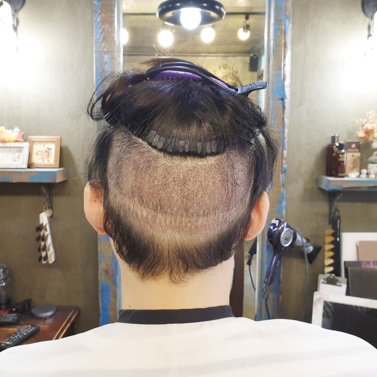  김학래모발이식 어디서 했나요?