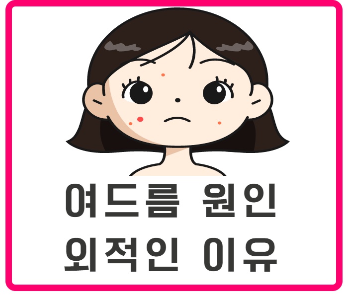 여드름 발생 원인부터 알고 피부관리 할 수 있어요