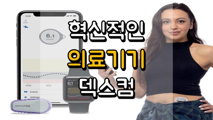  혁신적인 의료기기!! 덱스컴 - 주가 전망, 의료기기 관련주, DXCM