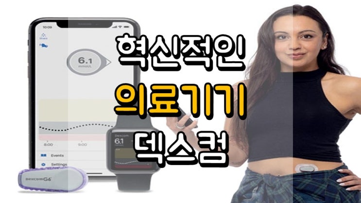 혁신적인 의료기기!! 덱스컴 - 주가 전망, 의료기기 관련주, DXCM