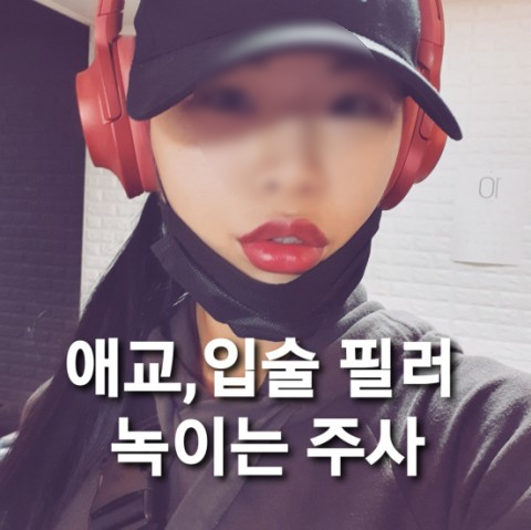  입술 필러 녹이기 애교필러 녹이는 주사