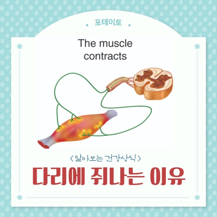  다리 쥐나는 이유와 원인 해결법 알아보자!