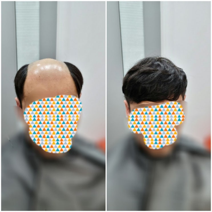  레이스가발 그것이 알고싶다!춘천가발전문점 가발덕후 은주누나