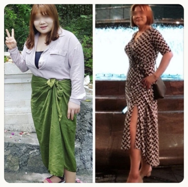  범어동다이어트 / 4개월에 -25키로 빼고 다이어트성형 성공~!!(여성전용)