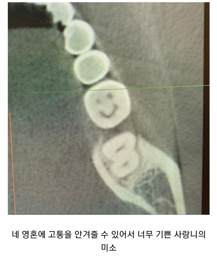  이름 변경 시급한 애니