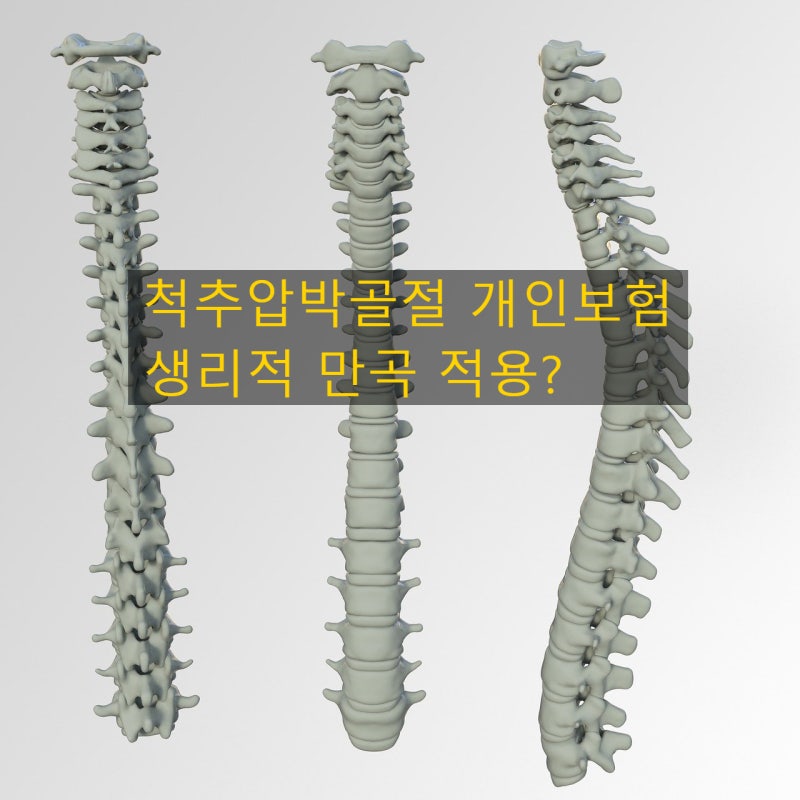 흉추요추골절 생리적만곡 적용해야하나 : 네이버 블로그