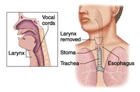 호흡기계 구조기능 상부하부기도 호흡보조근 흉막강내압 인두후두 폐 기관 폐포