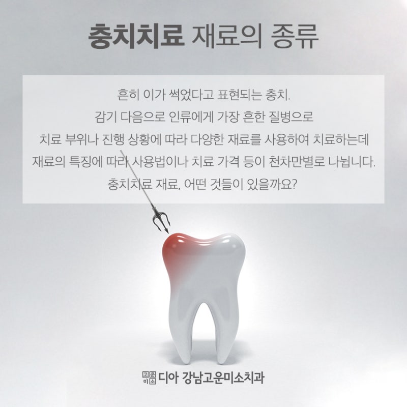 양재치과 충치 치료 시 보험 적용되는 재료에 대하여