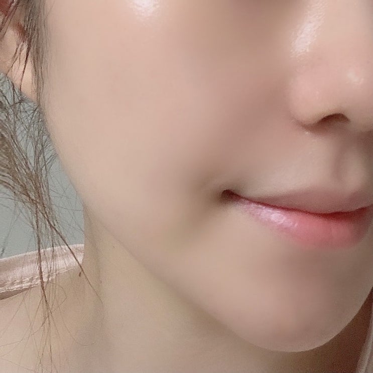  구래동 피부관리 여우곰뷰티 알라딘필링 후기