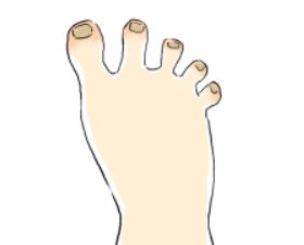  엄지발톱 가로줄 원인마다 다른 개선방법보기