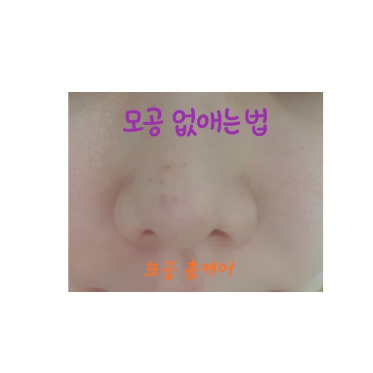  모공없애는법 모공홈케어 하는 방법
