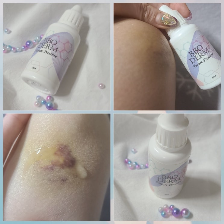 약국멍크림 비비오덤 멍크림 비싼데 효과는 ? 내돈내산 솔직후기 약국멍크림 비비오덤 멍크림 비싼데 효과는 ? 내돈내산 솔직후기