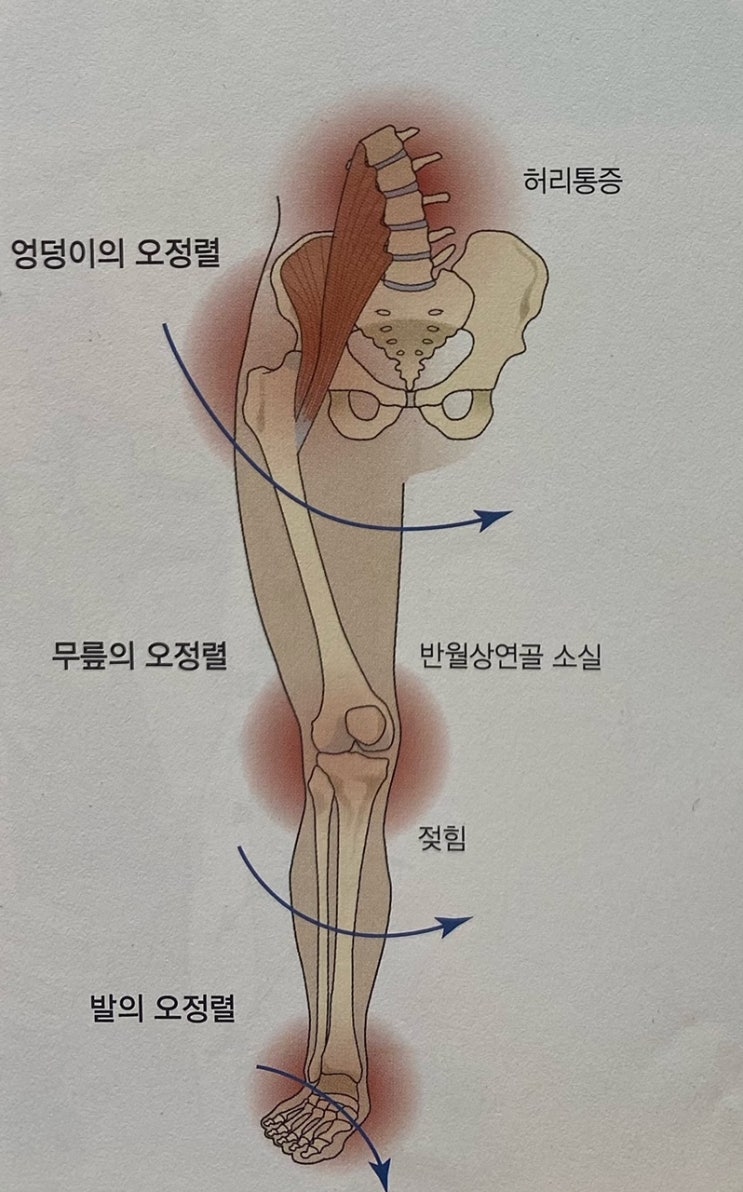 [이수역필라테스] 동적 부정렬로 인한 하지운동손상 증후군 & 상지운동손상증후군 관련 편