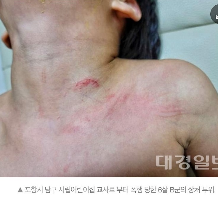 포항 어린이집 학대 사건 6살 아이 폭행 사건 어린이집 이름 위치 교사 최씨 궁금한이야기Y