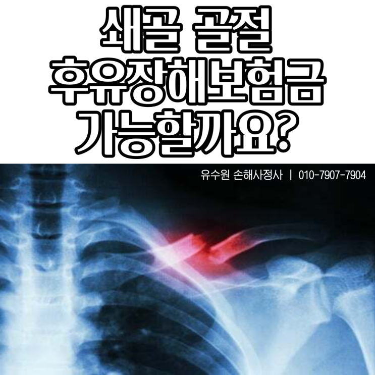  쇄골골절 후유장해보험금 청구 가능할까