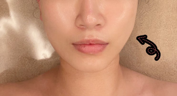  수완지구윤곽관리 작은얼굴 전문 뷰티스토리 리얼 후기