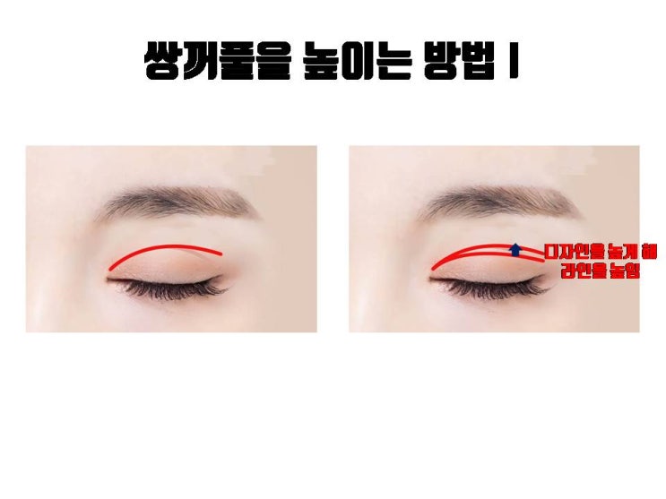  쌍꺼풀 라인 높이는 방법은 두 가지나 있어요!!!