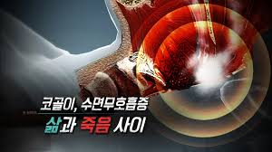  코골이 원인증상 약물수술치료 병원진단 수면다원검사 수면무호흡증합병증 산소부족 간호중재진단