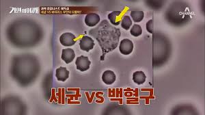  백혈구 정상수치 기능역할 백혈구종류수명 림프구단핵구 호중구호산구호염기구 식균작용 체액성세포성면역