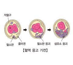  혈소판 정상범위 지혈역할기능 혈액응고기전과정 헤파린약물기전 혈전섬유소 항응고인자