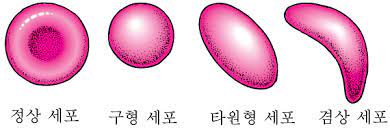  적혈구 혈액검사정상수치 빈혈황달수치 헤마토크리트침강속도 혈색소용혈 조혈과정순서 빌리루빈대사과정