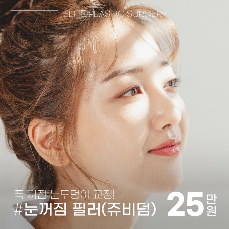 인천 구월동 필러 재시술 실패가 없어야 한다