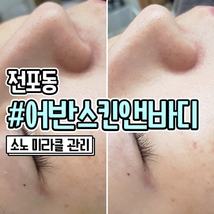  서면 피부관리 잘하는 전포동 어반스킨앤바디