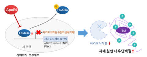  치매를 악화시키는 새로운 위험인자